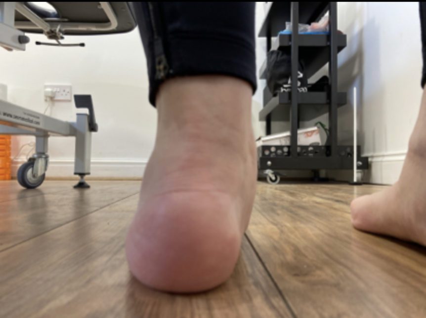 Can Your Feet Cause Back Problems