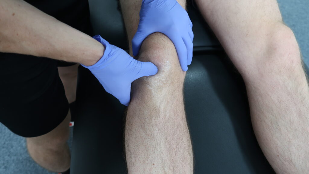 Patellar Tendinitis