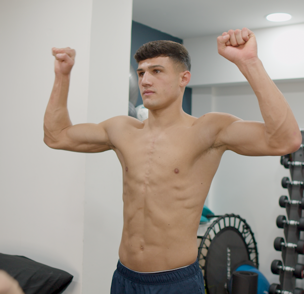 shoulder dislocation