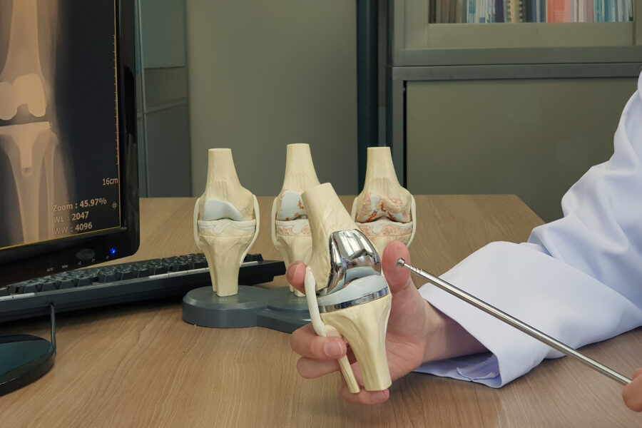 knee replacement