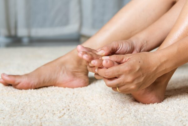Runner with stress fracture getting treatment at sharp physiotherapy Bawtry, Lincoln and Newark.