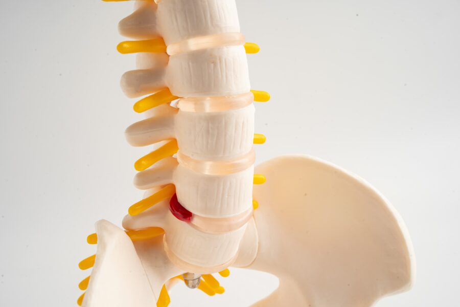 slipped disc